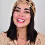 نمونه درمان کامپوزیت دکتر فروغ فدوی 2